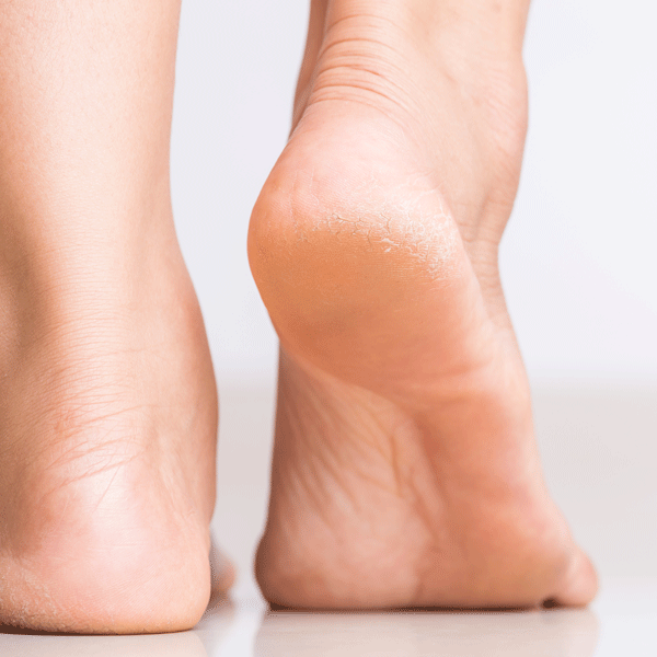Treatment for heel pain